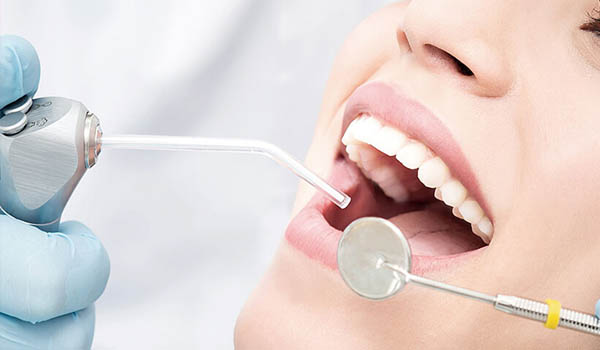 dental-fillings-in-pitampura